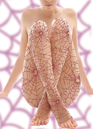 SPIDER 1