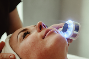 Dermatologia luz